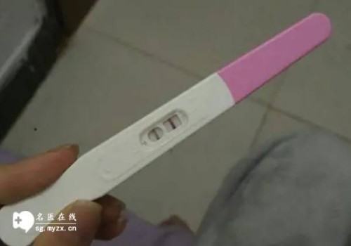 上海市：胎位不正是不能顺产吗,胎位不正是什么原因导致的