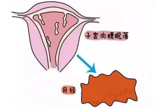 不同程度输卵管堵塞对试管成功率影响不同，看看你属于哪一种堵塞